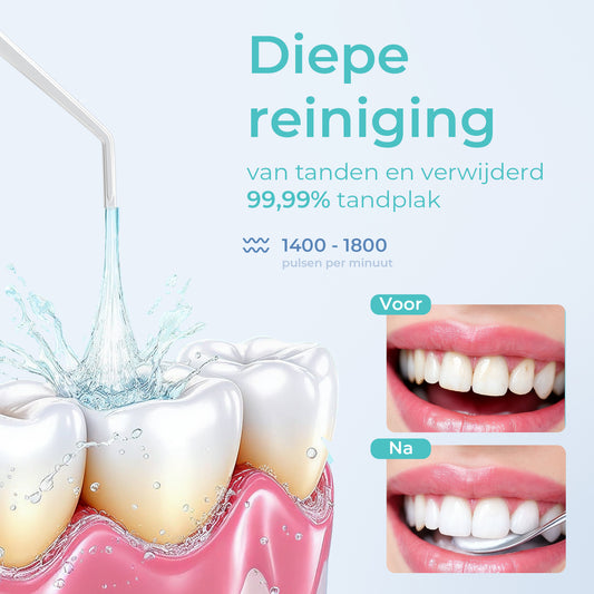 Mondura® Waterflosser Draadloos