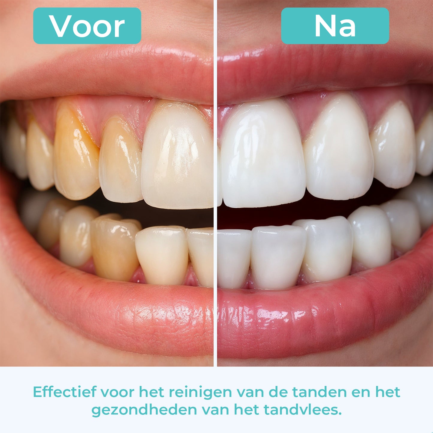 Mondura® Waterflosser Draadloos